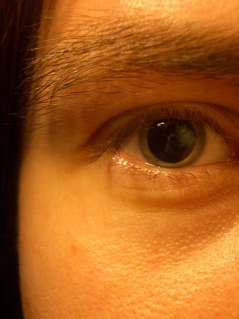 one pupil dilated suddenly one pupil dilated suddenly