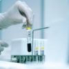 Can a Saliva Drug Test Replace a Urine Drug Test?