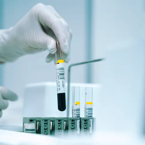 Understanding Drug Test Adulteration